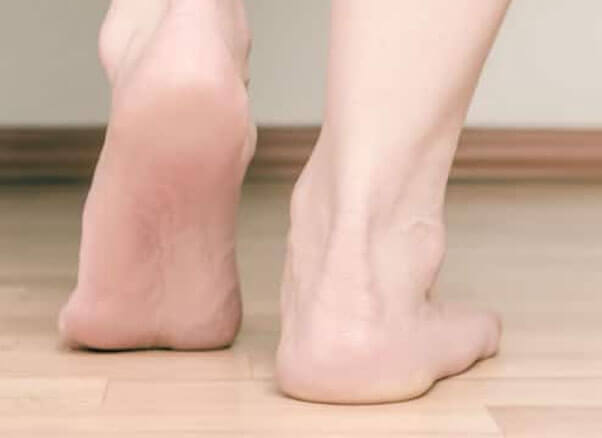 Flat Feet Treatment
