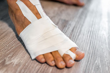 Foot Fractures treatment